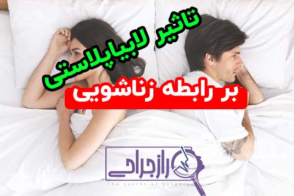 تاثیر لابیاپلاستی بر رابطه زناشویی راز جراحی