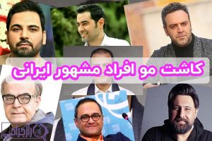 کاشت مو افراد مشهور ایرانی راز جراحی