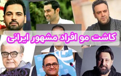 کاشت مو افراد مشهور ایرانی