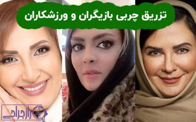 تزریق چربی بازیگران و ورزشکاران