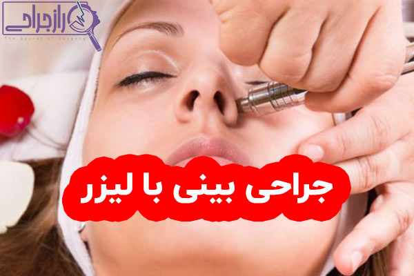 جراحی بینی با لیزر