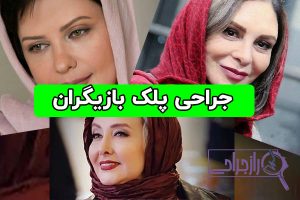 بازیگرانی که جراحی پلک انجام داده اند