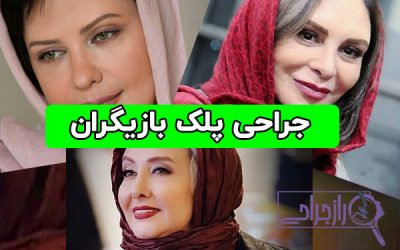 بازیگرانی که جراحی پلک انجام داده اند