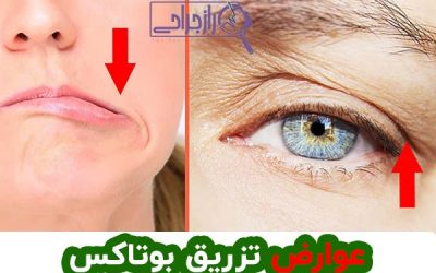 عوارض تزریق بوتاکس