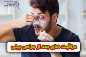 مراقبت های بعد از جراحی بینی