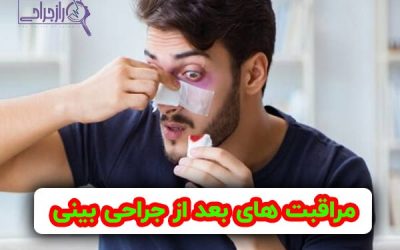 مراقبت های بعد از جراحی بینی