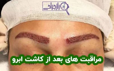 مراقبت بعد از کاشت ابرو