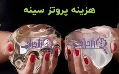 هزینه پروتز سینه