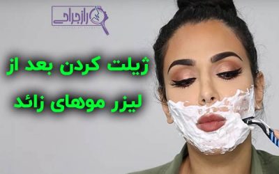 مراقبت بعد از لیزر موهای زائد