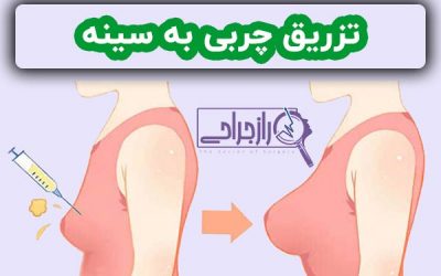 تزریق چربی به سینه