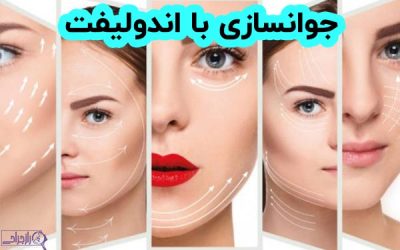 اندولیفت و جذابیت چهره ✨ راز جراحی