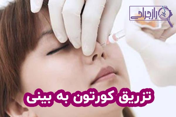 تزریق کورتون به بینی