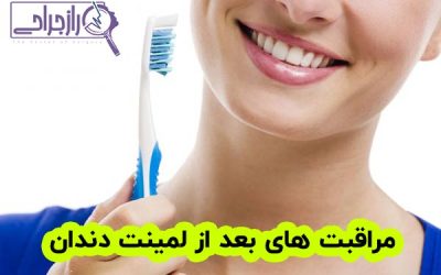 مراقبت های بعد از لمینت دندان