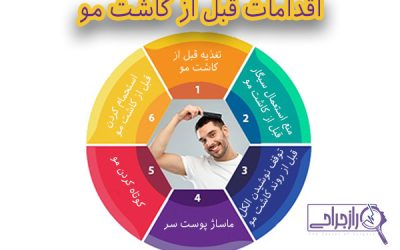 اقدامات قبل از کاشت مو