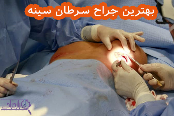 بهترین جراح سرطان سینه - راز جراحی