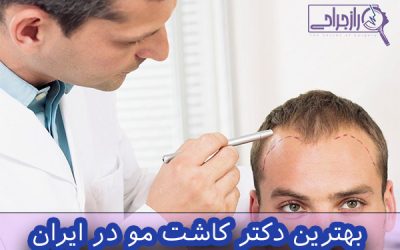 بهترین دکتر کاشت مو در ایران
