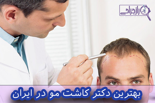 بهترین دکتر کاشت مو در ایران - راز جراحی