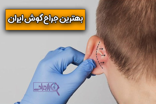 روش های انتخاب و تشخیص بهترین جراح گوش - راز جراحی