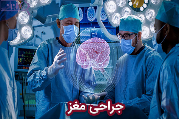 جراحی مغز - راز جراحی