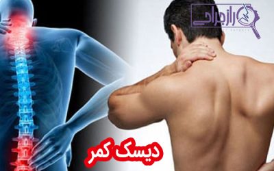 دیسک کمر