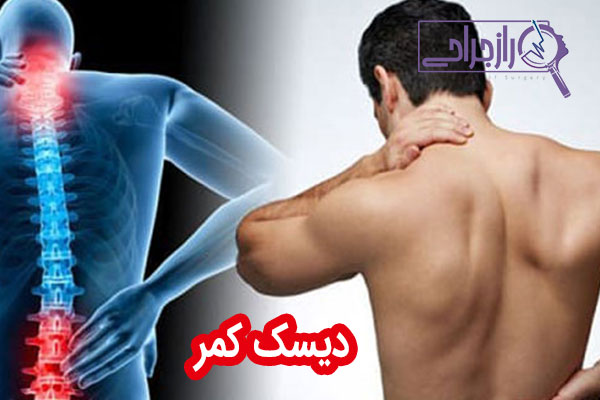 دیسک کمر - راز جراحی