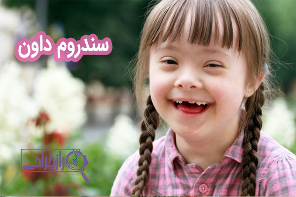سندروم داون - راز جراحی