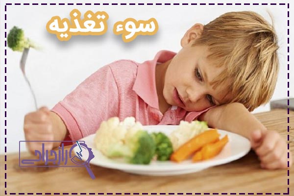 سوء تغذیه - راز جراحی