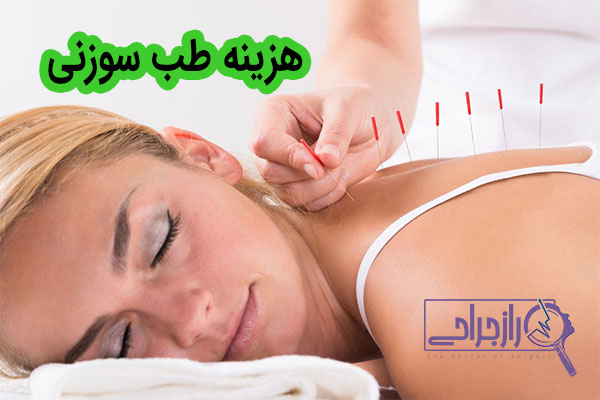 هزینه طب سوزنی - راز جراحی