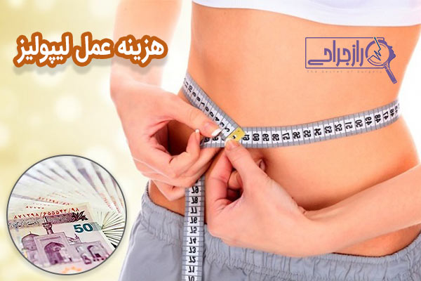 هزینه عمل لیپولیز - راز جراحی