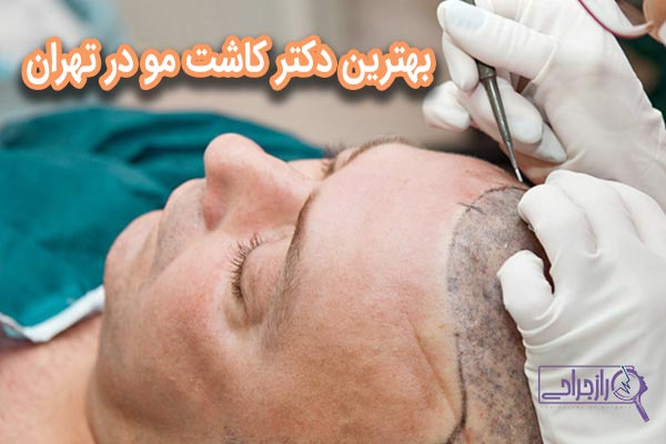 بهترین دکتر کاشت مو در تهران - راز جراحی
