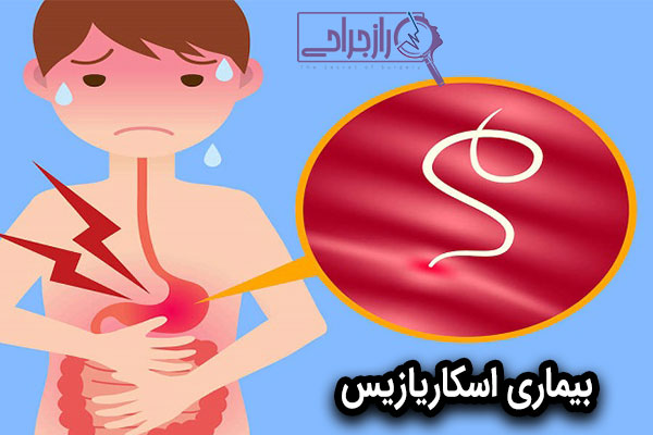 اسکاریازیس - راز جراحی