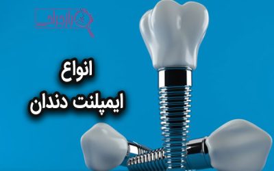 انواع ایمپلنت دندان