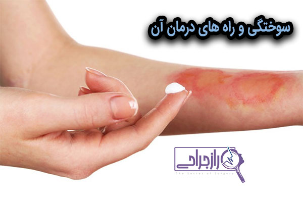 سوختگی - راز جراحی