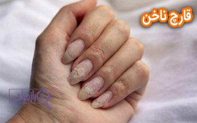 قارچ ناخن