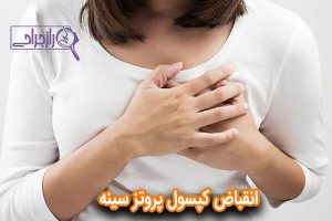 انقباض کپسول پروتز سینه - راز جراحی