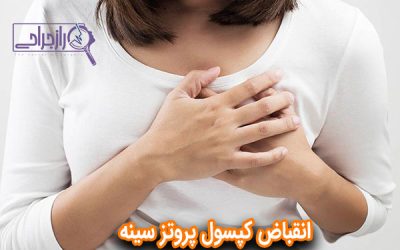 انقباض کپسول پروتز سینه