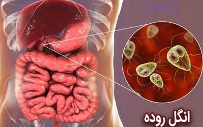 انگل روده