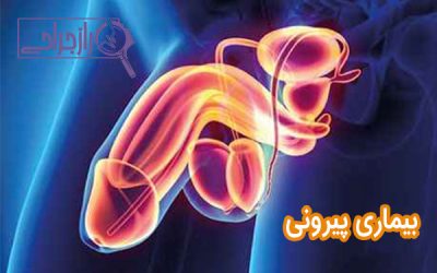 بیماری پیرونی