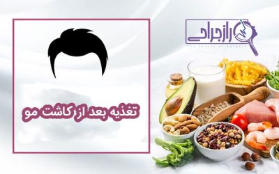 تغذیه بعد از کاشت مو