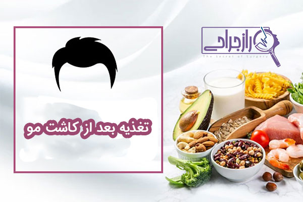 تغذیه بعد از کاشت مو - راز جراحی