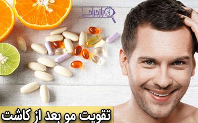 تقویت مو بعد از کاشت