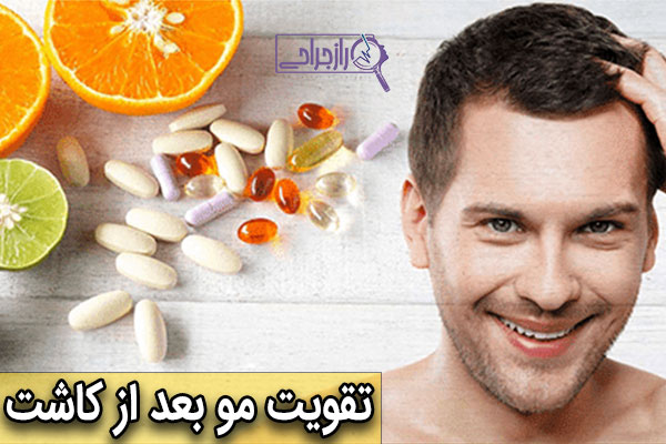 تقویت موها بعد از کاشت - راز جراحی