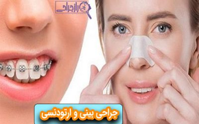 جراحی بینی و ارتودنسی