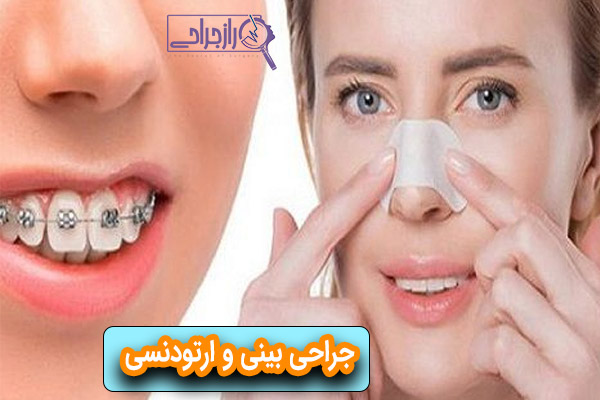 جراحی بینی و ارتودنسی - راز جراحی