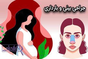 جراحی بینی و بارداری - راز جراحی