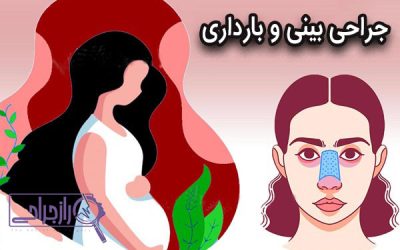 جراحی بینی و بارداری