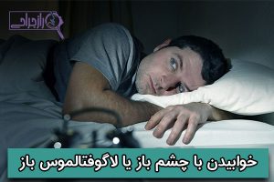 خوابیدن با چشم باز - راز جراحی