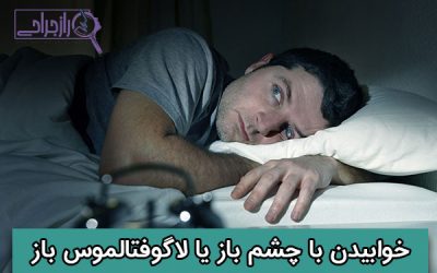 خوابیدن با چشم باز یا لاگوفتالموس باز