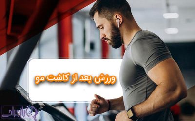 ورزش بعد از کاشت مو + راز جراحی