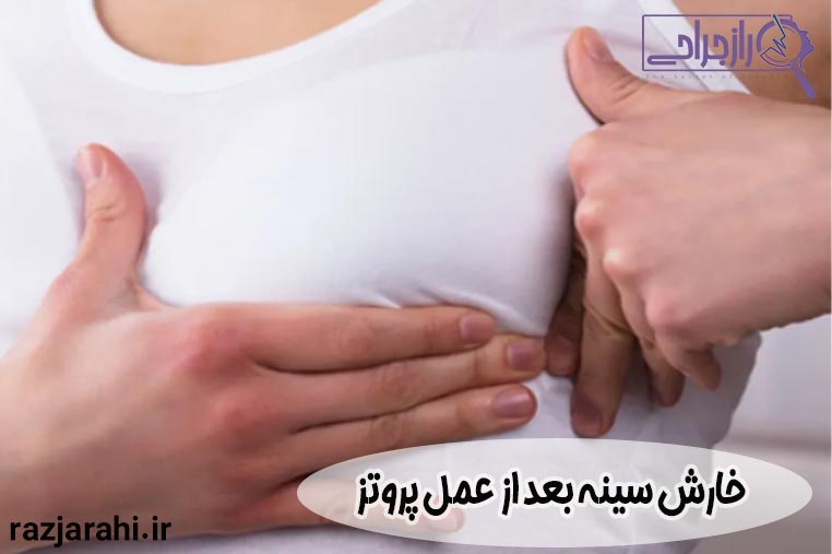 خارش سینه بعد از عمل پروتز